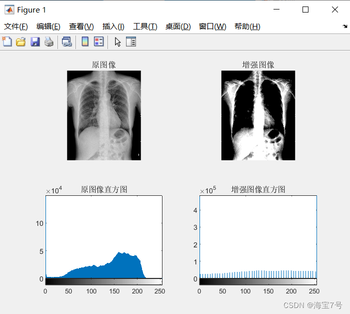 [Chapter 26 medical impact segmentation system based on minimum error method and region growth -- matlab deep learning practical GUI project]