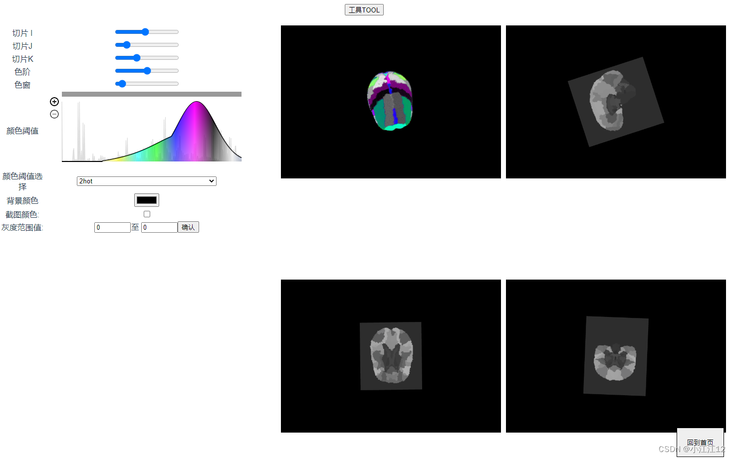 VTK. Le bouton gauche de la souris JS glisse pour changer le niveau et la largeur de la fenêtre