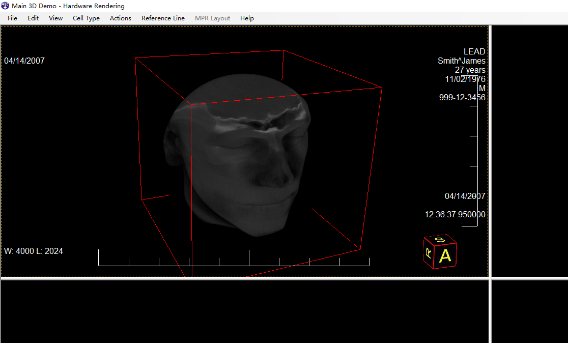 LEADTOOLS 22 套件 LEADTOOLS 超级套