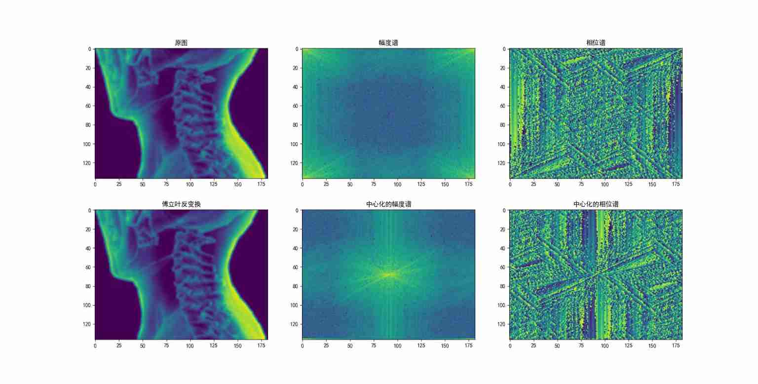  Insert picture description here 