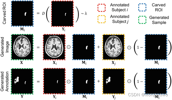 [论文阅读] CarveMix: A Simple Data Augmentation Method for Brain Lesion Segmentation