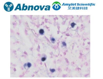 Abnova CMV CISH probe solution