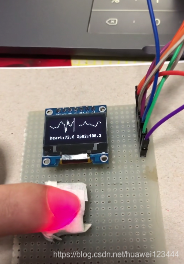  Insert picture description here 