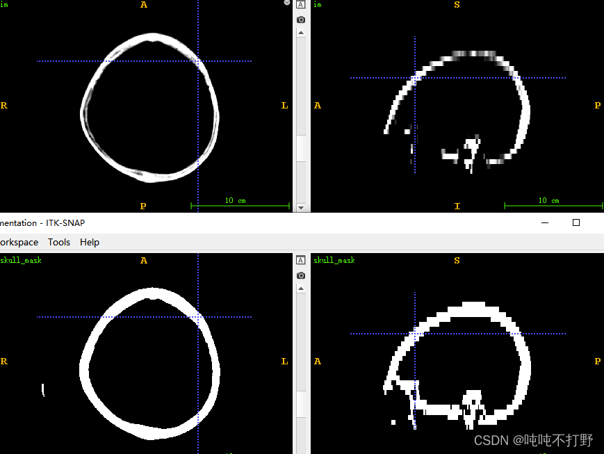 Simpleitk use - 3 Common operations