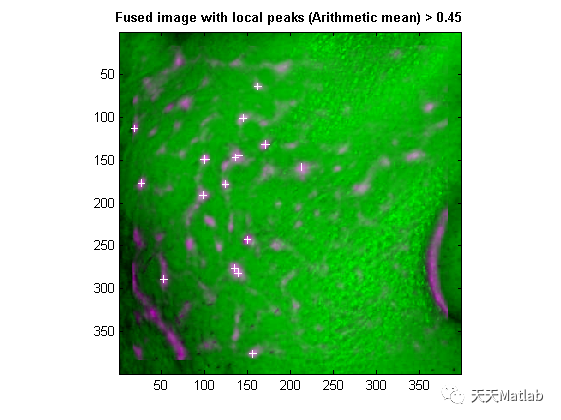 【图像检测】基于Combined Separability Filter实现鼻孔和瞳孔等圆检测matlab源码