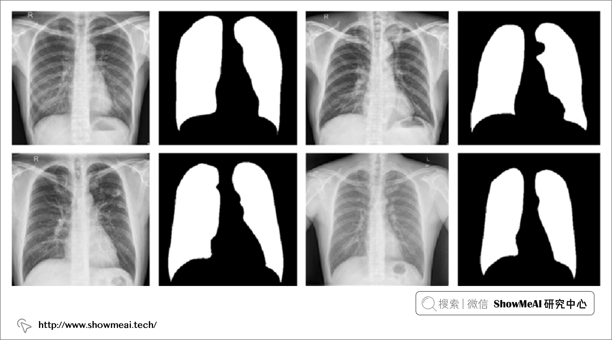 AI+医疗：使用神经网络进行医学影像识别分析