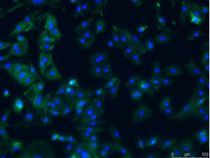 Abbkine trakine F-actin Staining Kit (green fluorescence) scheme