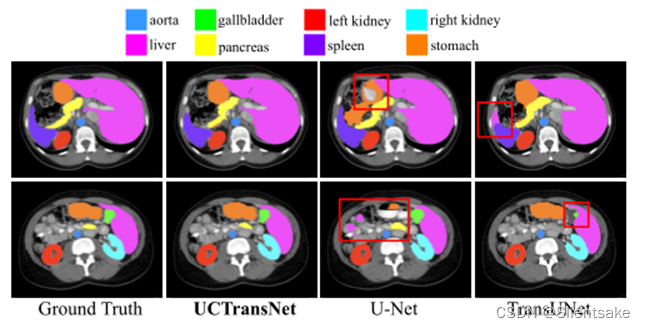 [notes of in-depth study paper]uctransnet: rethink the jumping connection in u-net from the perspective of transformer channel