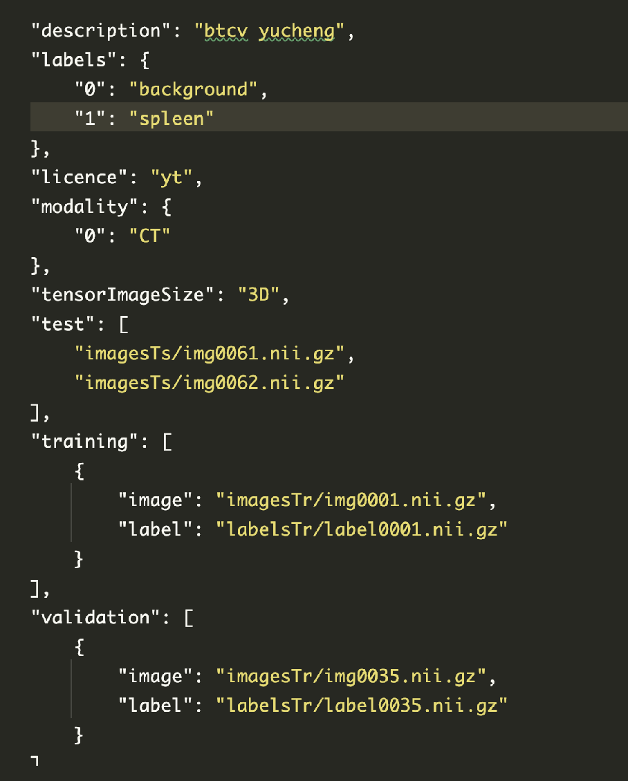 Use load_ decathlon_ Datalist (Monai) fast loading JSON data