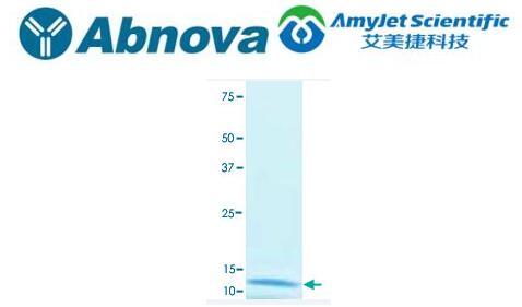 Abnova丨E (DIII) (WNV) 重组蛋白 中英文说明书