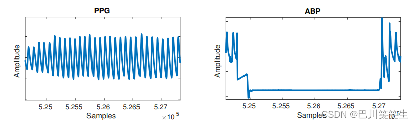 Estimate blood pressure according to PPG using spectral spectrum time depth neural network [turn]